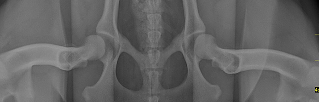 Juvenile Pubic Symphysiodesis
